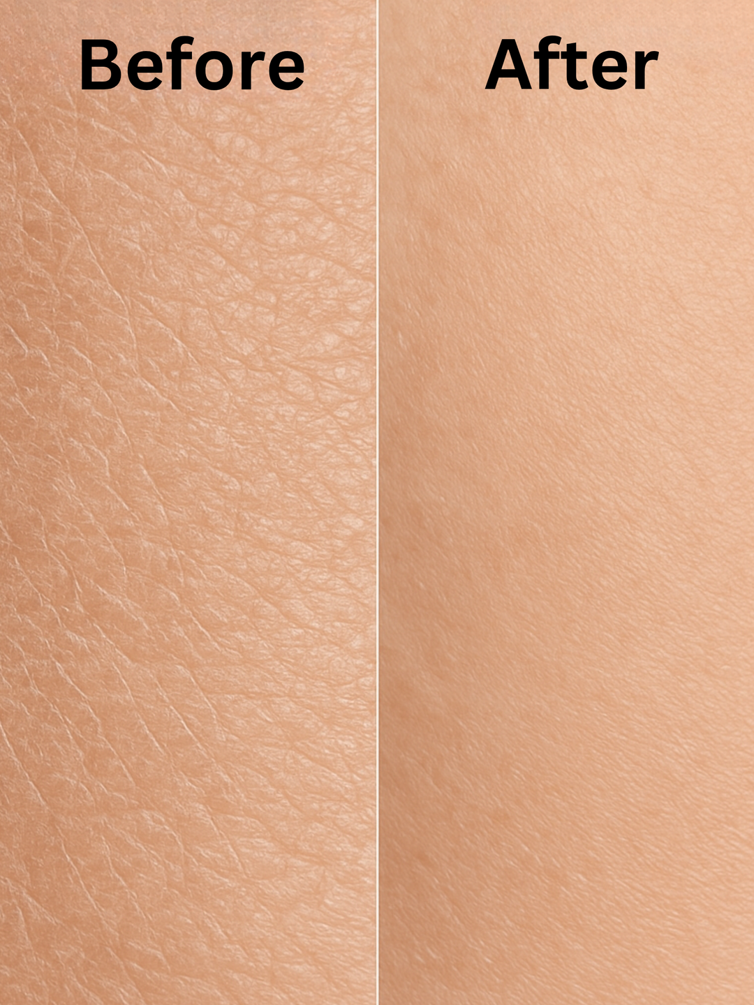 Urea Body Cream for Rough Skin