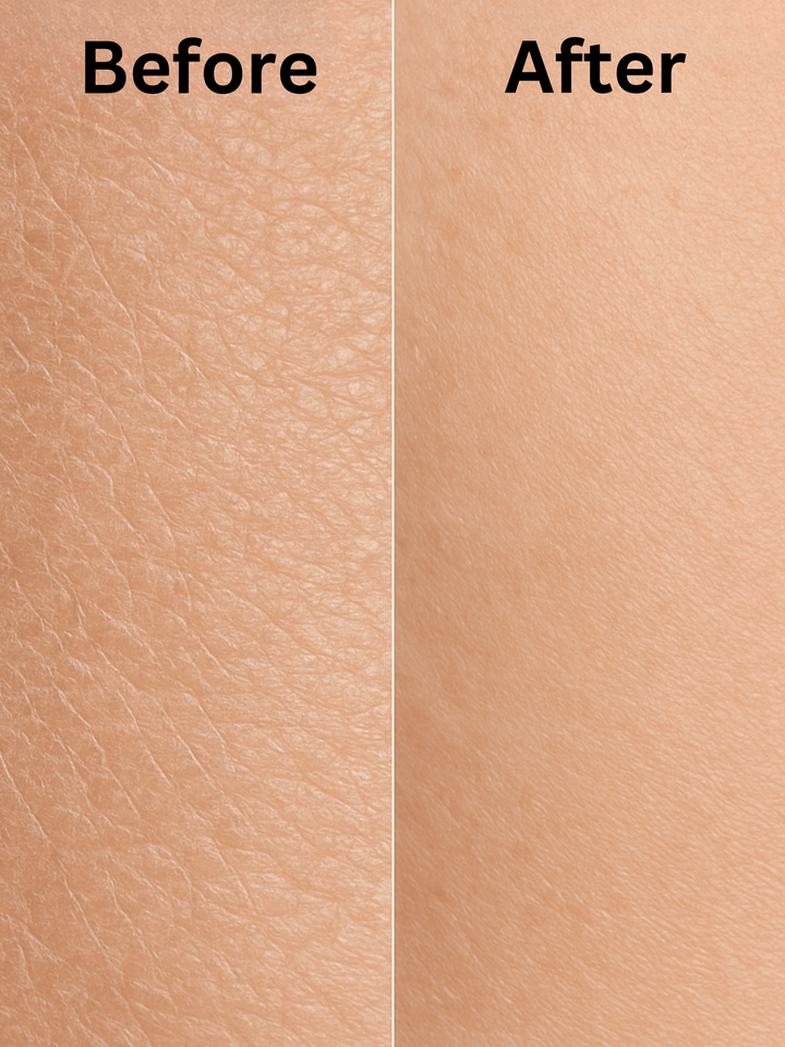 Urea Body Cream for Rough Skin