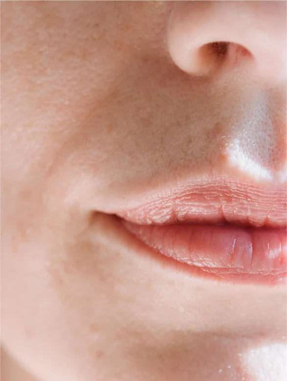 Sensitive Skin Moisturizer